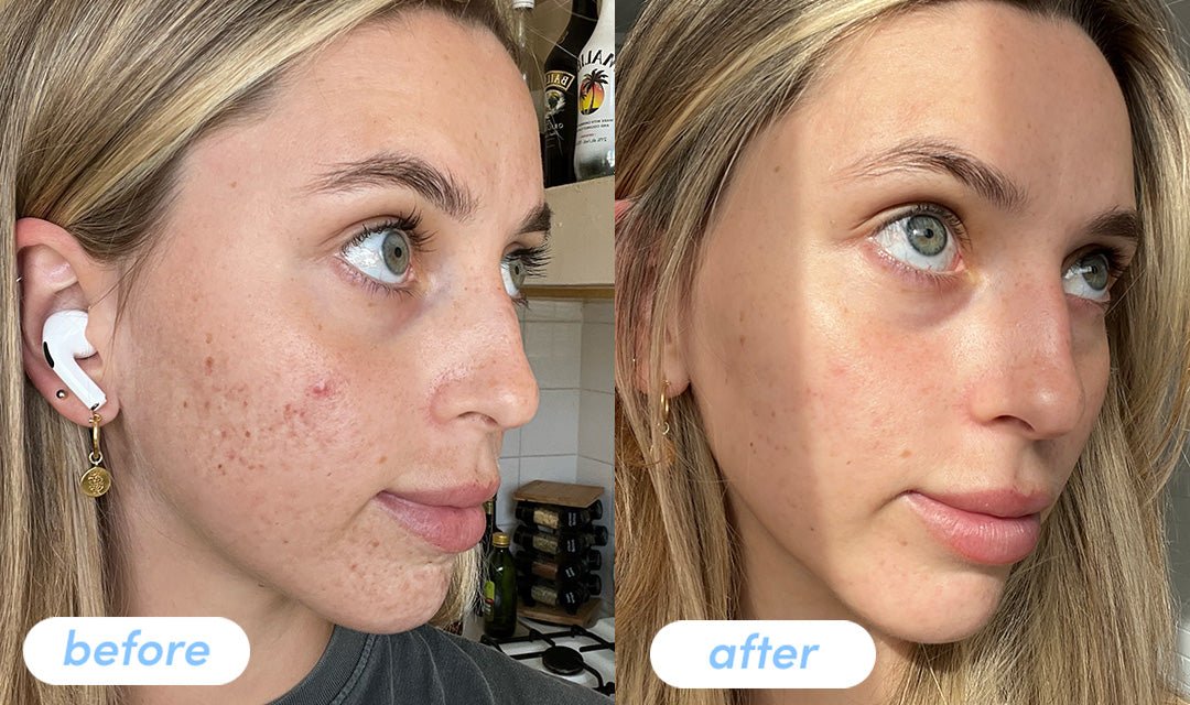Bonnie K Taking Premium Collagen Peptides For 8 Weeks The Collagen Co bonnie-k-taking-premium-collagen-peptides-for-8-weeks-the-collagen-co