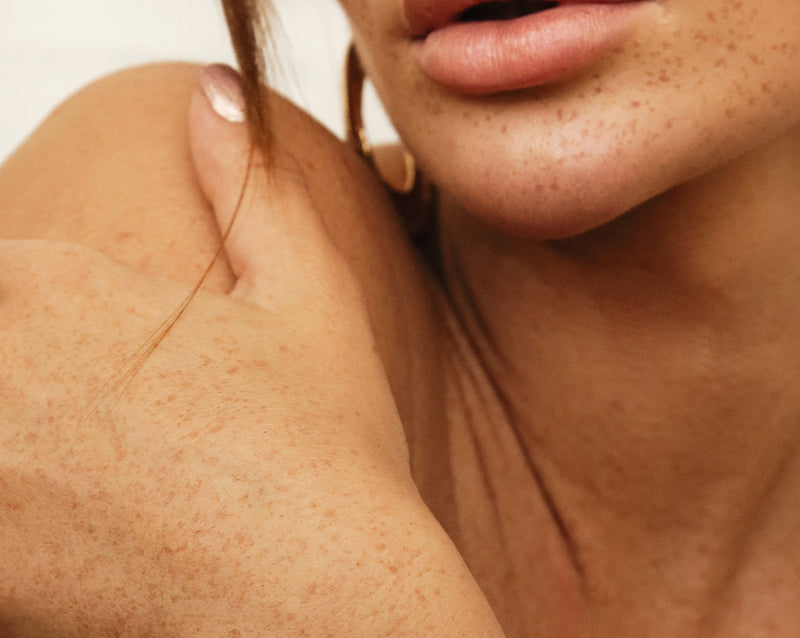 Close-up of a woman's freckled shoulder and lips, highlighting natural skin texture and beauty.