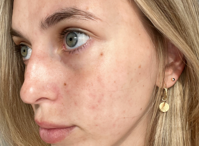 Close-up of a woman's face showing clear skin texture, subtle freckles, and gold earrings; highlights natural beauty and skincare results.