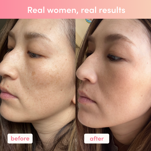 Side-by-side comparison of a woman's face showing skin improvement before and after using collagen supplements.
