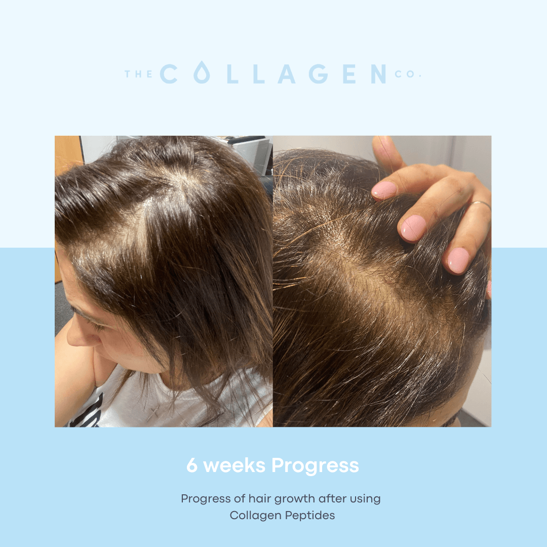 How Jeanette recovered from Postpartum and Virus-related hair loss - The Collagen Co.