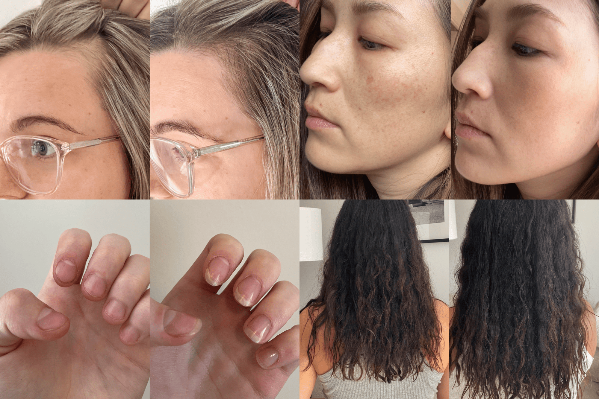 What to Expect before and after Collagen (4 Results Backed with Customer Photos) - The Collagen Co.