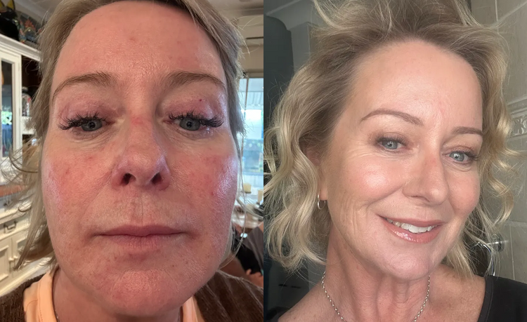 Foto comparativa facial