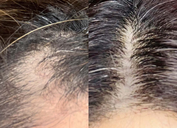 Foto comparativa del cabello