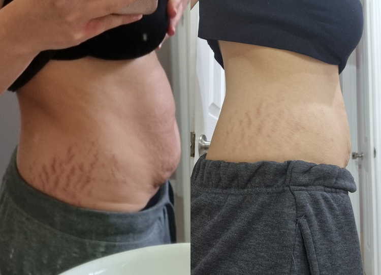 Foto comparativa de progreso