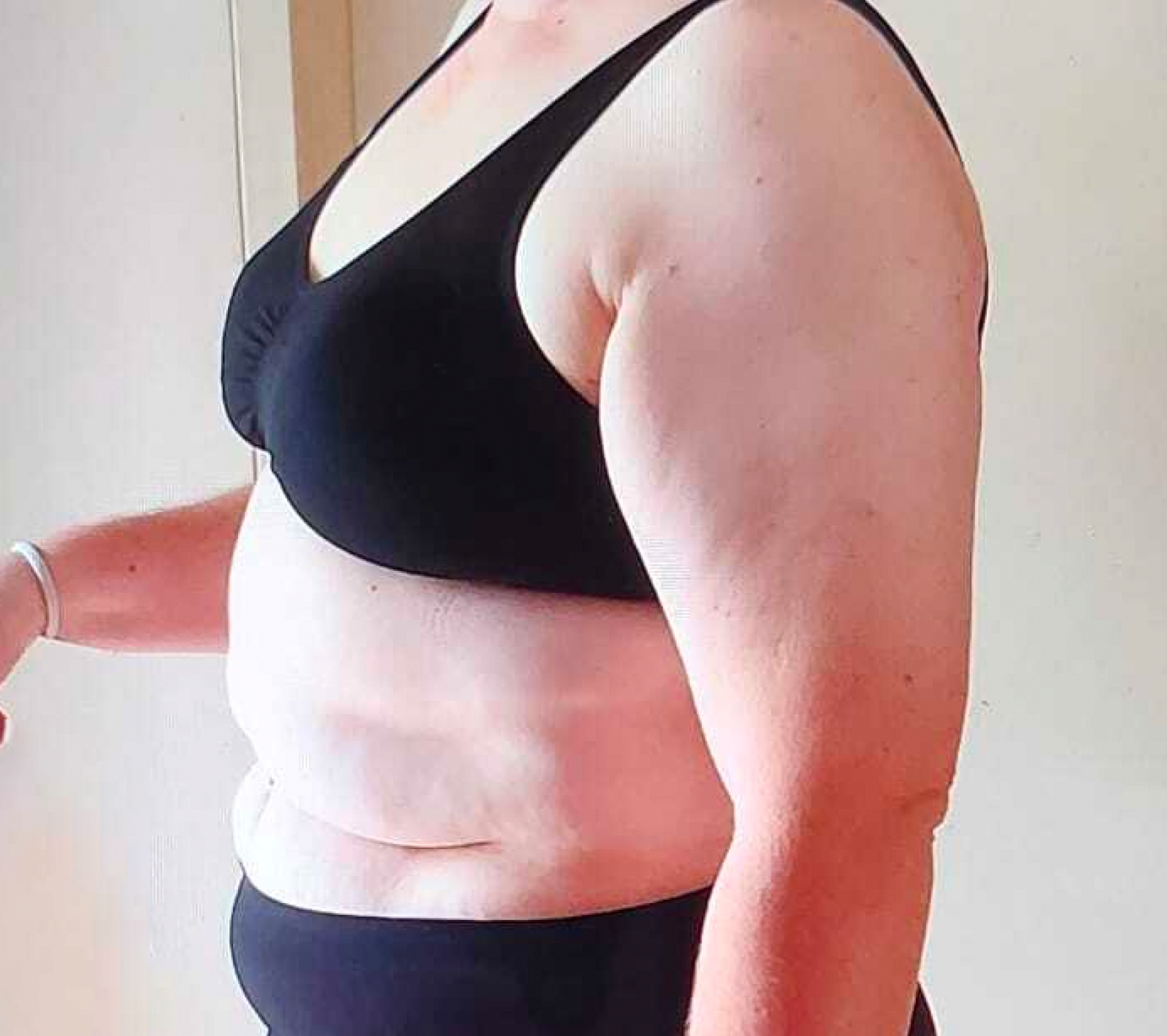 Person in black underwear showing side profile, focusing on skin, health, and body transformation in context of beauty and wellness.