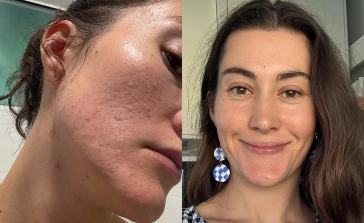 Foto comparativa facial