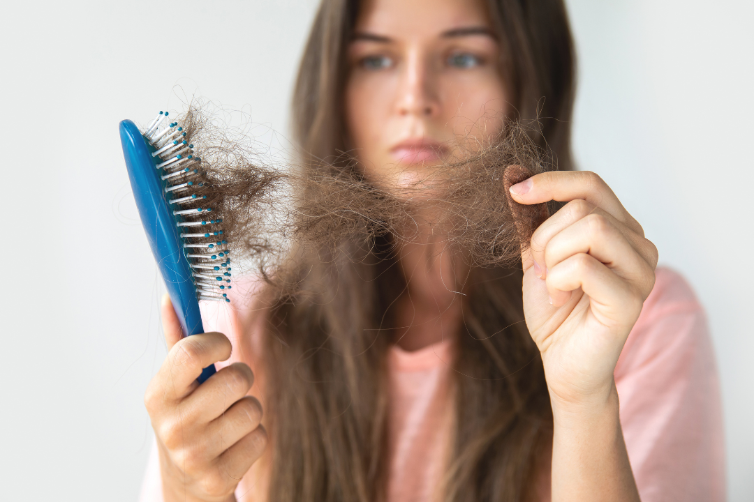 Woman holding a hairbrush with clumps of hair, indicating hair loss. Focus on need for beauty supplements like collagen for healthy hair.