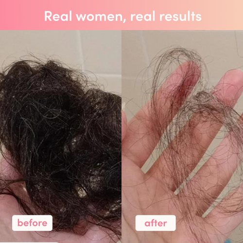 Before and after hair comparison; left shows thick hair clump, right shows reduced hair loss. Text: "Real women, real results."
