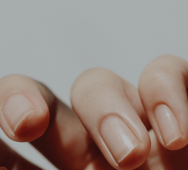 Close-up of well-manicured fingernails on smooth, soft skin, highlighting beauty and skincare benefits.
