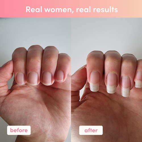Before and after image of hands showing nail growth, touting collagen supplement benefits. Text reads, "Real women, real results."