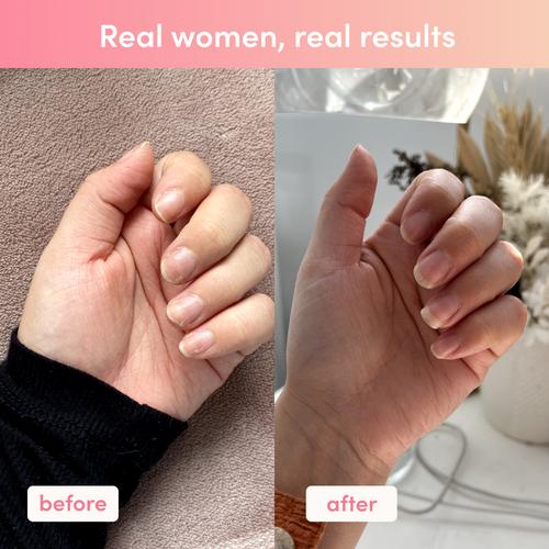 Before and after image of a woman's nails, showing improved length and health. Caption reads, "Real women, real results."
