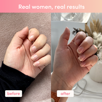 Before and after comparison of hands showing nail growth. Left hand nails are shorter and less healthy; right hand nails are longer and stronger.