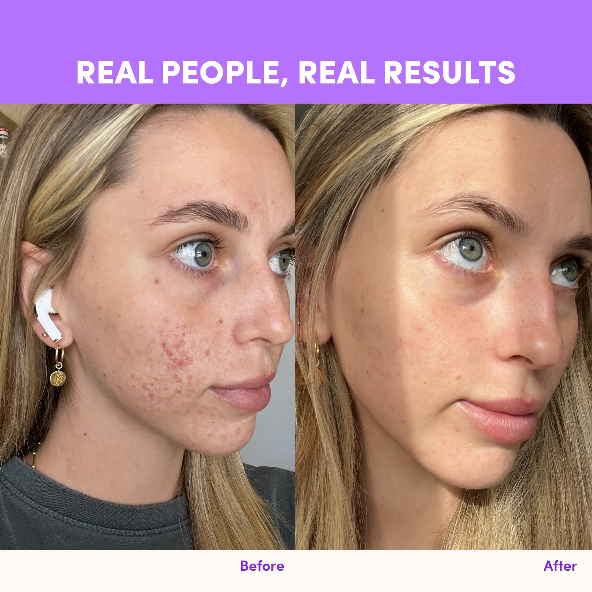 Purple Grape Collagen Sachets - 280g - The Collagen Co.